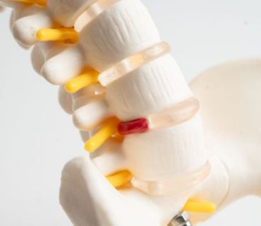 herniated disc treatment orange county ca herniated disc treatment orange county ca