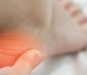 plantar fasciitis orange county ca plantar fasciitis orange county ca