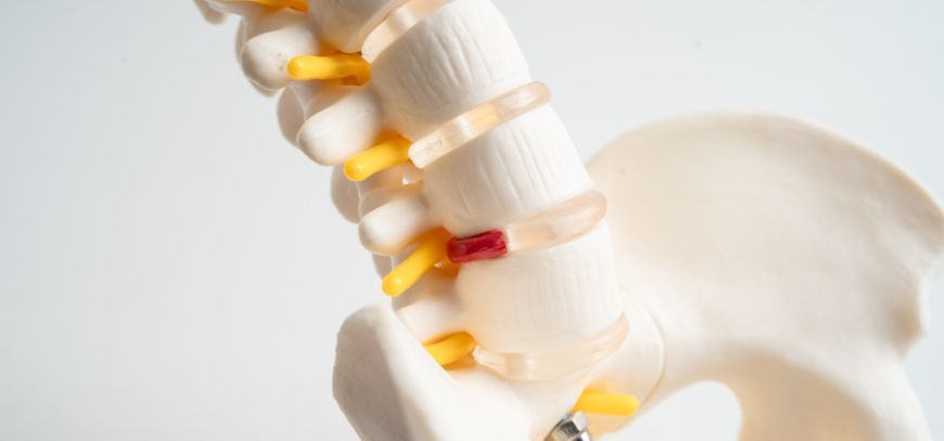 herniated disc treatment san diego ca