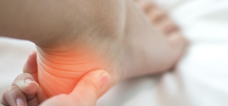 plantar fasciitis treatment san diego ca